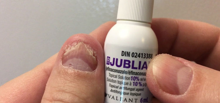 order cheaper jublia online in Ascutney, VT